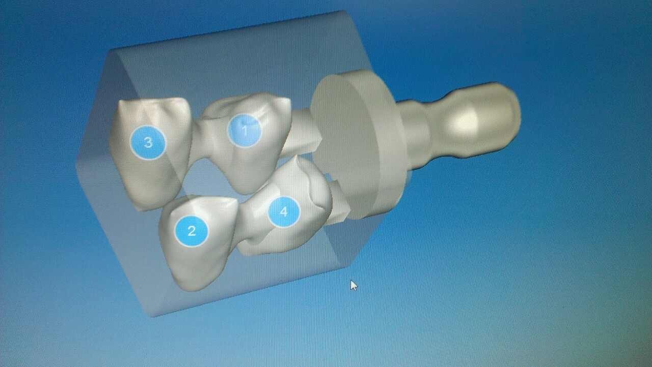 Frese Diamantate Dentali Kit FG0710D Per Preparazione Denti Posteriori In Ceramica E Zirconio Frese Ceramica Per Corona Dentale - Foto 9